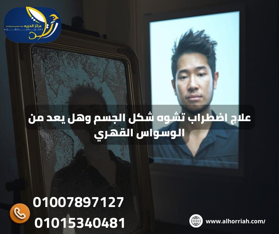 اضطراب تشوه شكل الجسم